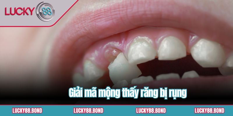Giải mã mộng thấy răng bị rụng